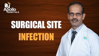 SURGICAL SITE INFECTION [upl. by Anetta]