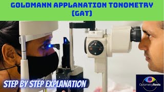 Tonometry  Goldmann Applanation Tonometry  IOP optometryreels [upl. by Rashida]