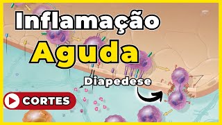 Inflamação Aguda  Patologia Geral [upl. by Malcah]