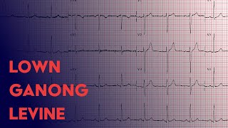 Lown Ganong Levine  ECG EKG Interpretation [upl. by Granoff546]