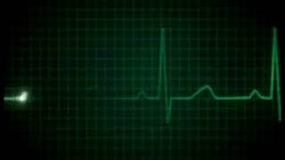 Heart beat going to death die  ecg  doctor  heart beat monitor [upl. by Adiuqram404]