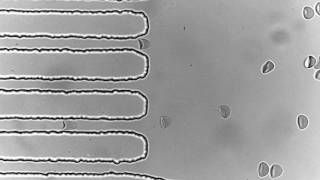 Deformation of red blood cells [upl. by Monreal]