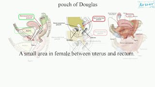 Anatomy and Clinical anatomy of Pouch of Douglas Rectouterine pouch Rectovesical pouch [upl. by Placida]