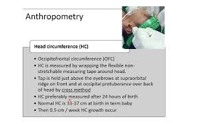 Anthropometry Measurements in Newborn  Pediatrics [upl. by Heindrick]