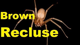 🕷️ Brown Recluse Revealed 10 Alarming Facts amp Bite Info  2024 Update  TheCoolFactShow [upl. by Leibman]