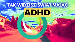 5 OBJAWÓW ADHD u dorosłych [upl. by Harad]