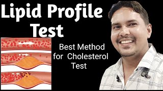 Lipid profile test and Method [upl. by Akelahs]