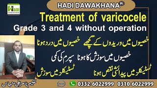 Varicocele symptoms and treatment  Varicocele treatment in urdu  Varicocele kya hai  Varicocele [upl. by Elisabetta]