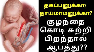 umbilical cord around the baby neckpregnancy tipsகுழந்தை கொடி சுற்றி பிறந்தால் ஆபத்து யாருக்கு [upl. by Collen]