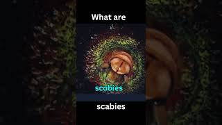 What are Scabies [upl. by Linea]