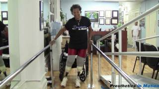 Bilateral Below the Knee Amputee Walks in Vacuum Prostheses for the 1st Time [upl. by Loram]