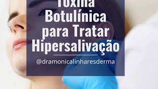 Toxina Botulínica para Tratar Hipersalivação [upl. by Faustus]