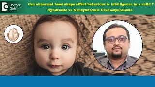 Does head shape affect intelligence Craniosynostosis  Head shape DrVybhav DerajeDoctors Circle [upl. by Carleton]