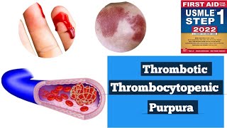 Thrombotic thrombocytopenic purpura TTPHUS Hematology lacturesDoctors goal [upl. by Ahcsatan]