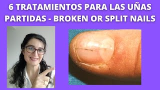 Treatment for BROKEN NAILS or SPLIT NAILS 💅 6 TrataMientoS para UÑAS PARTIDAS 💅 [upl. by Keyte]