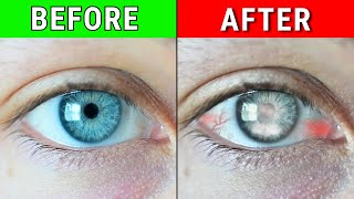 9 Habits secretly Ruining Your Eyes [upl. by Lazos]