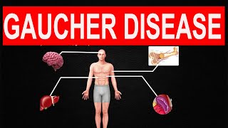 Gaucher Disease [upl. by Ayhtak]