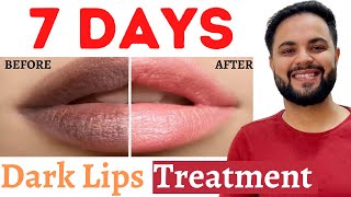 7 Days Dark Lips Removal Challenge  Pigmented Lips Treatment [upl. by Adiene471]