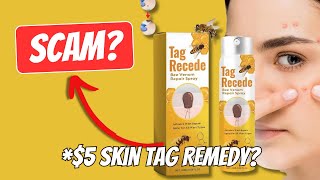 Flysmus Tag Recede Bee Venom Treatment Spray Review Does this Works [upl. by Adahsar]