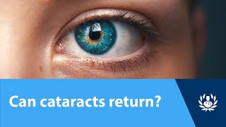 Can cataracts return [upl. by Diella]