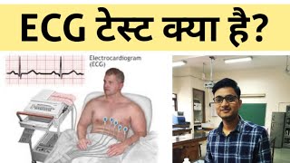 ECG Test in Hindi  ईसीजी टेस्ट क्या है और क्यों किया जाता है  Electrocardiogram [upl. by Haibot]