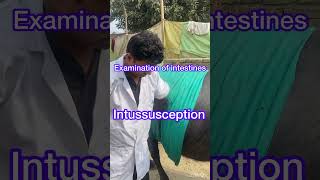 Diagnosis of Intussusception l dr Umar khan [upl. by Eelamme987]