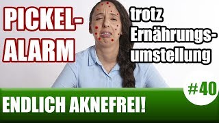 HautproblemePickel trotz ErnährungsumstellungENDLICH AKNEFREI 40 [upl. by Jerrilyn]