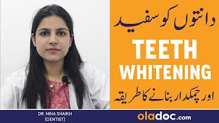 TEETH WHITENING IN URDU  Danto Ko Safaid Karne Ka Tarika  Dental Bleaching Treatment amp Procedure [upl. by Havelock816]