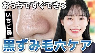 【いちご鼻から卒業】おうちでできる、鼻の毛穴の黒ずみを撃退する方法を美容のプロが解説 [upl. by Madda]