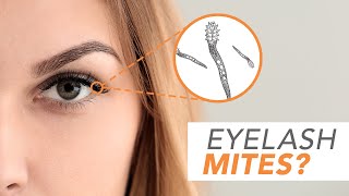 What are Demodex Mites Optometrist Explains [upl. by Hooper]