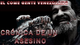 EL COME GENTE VENEZOLANO  Dorancel Vargas [upl. by Hartill]