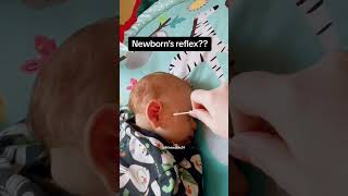 Newborn reflex newbornbaby newborn babyreels babyreactions babyvideos babyshorts babylove [upl. by Dnamron]