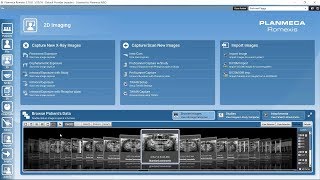 Working with Planmeca Romexis 2D module [upl. by Garlinda]