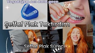 Şeffaf Plak Taktırdım  invisalign Tedavisi  Şeffaf Plak Sürecinde Yaşadıklarım [upl. by Ivey]