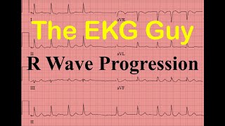 EKGECG R Wave Progression  Question 120  The EKG Guy [upl. by Hakym]