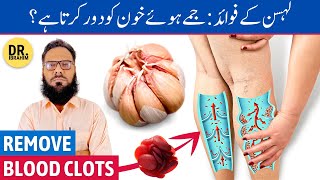 Lahsun Ke Fayde  Remove Blood Clots in Legs  Garlic Benefits  UrduHindi  Dr Ibrahim [upl. by Volin]