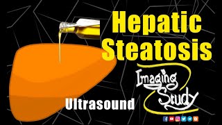 Hepatic Steatosis  Fatty Liver  Ultrasound Lecture  Imaging Study [upl. by Winwaloe]