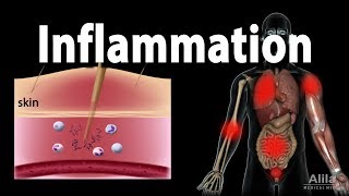 Inflammatory Response Animation [upl. by Eceirehs]