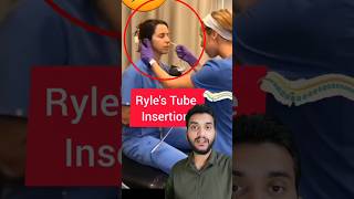 Ryles tube insertion shorts [upl. by Cherian772]