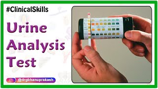 Urine analysis test procedure  Biochemistry Practicals [upl. by Chiang505]