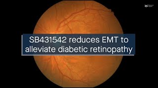 SB431542 reduces EMT in retinal pigment epithelial cells to alleviate diabetic retinopathy [upl. by Ethan773]