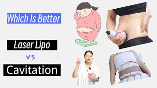 Laser Lipo vs Ultrasonic Cavitation Which Wins the Battle of Body Contouring [upl. by Hanafee]