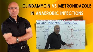 Clindamycin vs Metronidazole  Anaerobic Infections [upl. by Nylirehc]