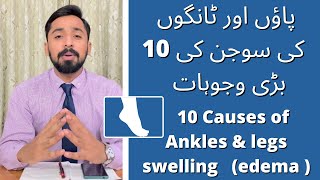 Top 10 causes of Ankle and leg swelling  swollen feet  Edema  paon ki sujan in UrduHindi [upl. by Nivle]