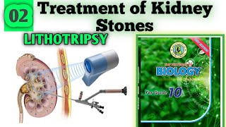 lithotripsy treatment for kidney stones 10 biology chapter 2 lithotripsy animation [upl. by Bearnard934]