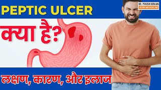 😨Peptic Ulcerपेट में अल्सर  Peptic Ulcer क्या है  Peptic Ulcer लक्षण कारण और इलाज in Hindi [upl. by Einuj]