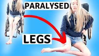 ♿️MY PARALYSED LEGS  limbdifferenceawarenessmonth [upl. by Gnilhsa]