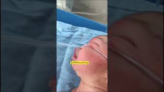 Opisthotonos posture in newborn  care of newborn baby  newborn born baby  youtubeshorts [upl. by Stoeber]