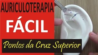 Auriculoterapia Fácil  Curso de Acupuntura Auricular [upl. by Dix440]