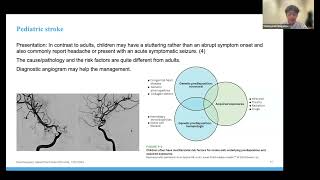 Pediatric NeuroEndovascular Intervention Tomoyoshi Shigematsu MD PhD January 31 2024 [upl. by Eeneg]